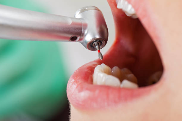 Best Emergency Treatment for Toothache in Woodbine, NJ